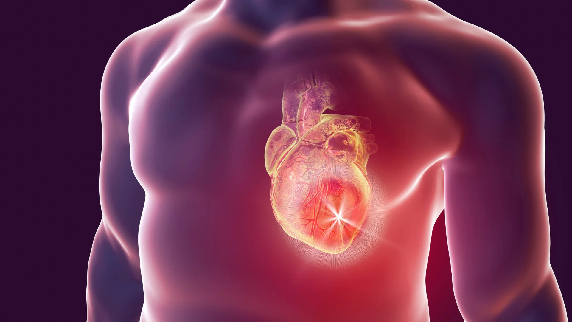 Ischemic Heart Disease